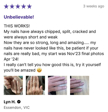 Screenshot of a 5-star customer review from Lyn H. in Essendon, VIC, showing before-and-after photos of her hands with visibly stronger, smoother nails after using Daline Magic Pen.