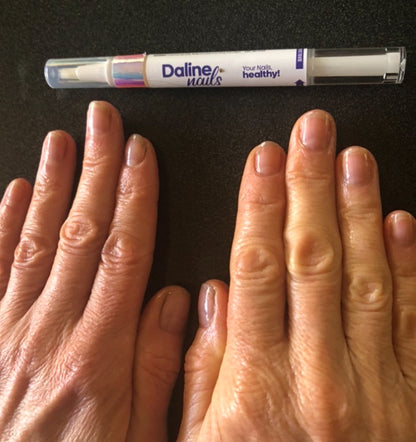 Magic Pen — Repair & Growth Nail Cream (Single Pen)